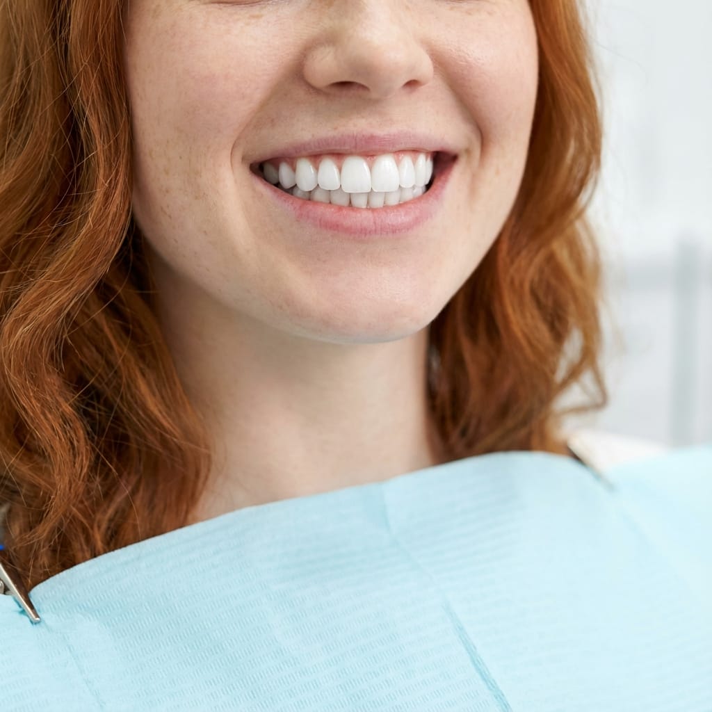 After Zoom Treatment